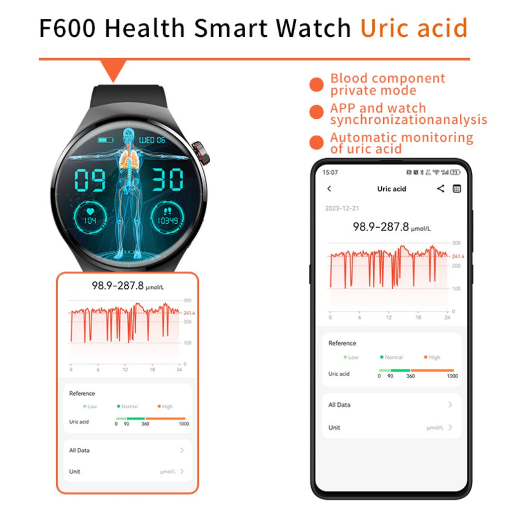 Nuevo reloj inteligente con disco de 1,55 pulgadas y monitor de salud.